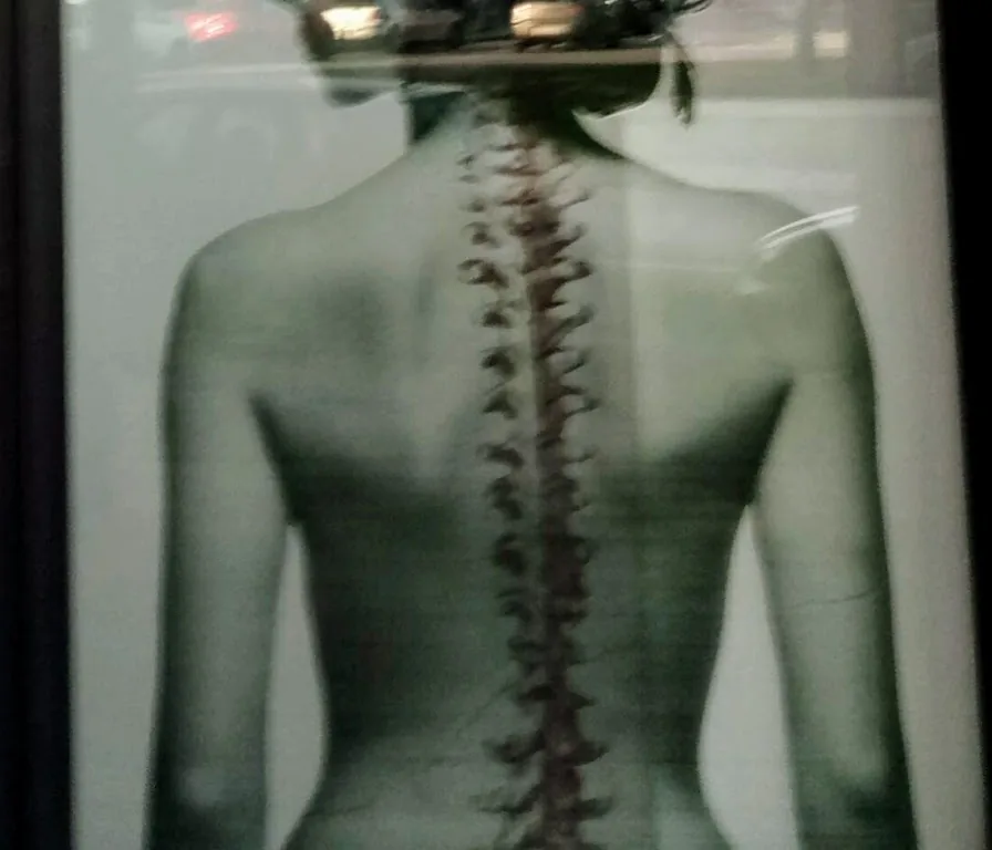 Lámina de la puerta de la clínica: una espalda con la columna vertebral dibujada